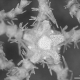 Ophiacantha dallasii, dorsal view